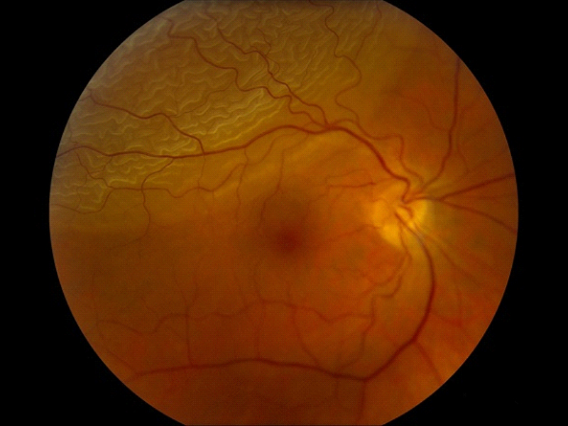 ophthalmic-emergency